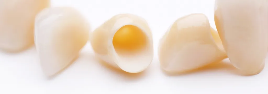 笑顔に自信、鏡を見るのが楽しみに。あなたの本来の輝きを引き出す、セラミック治療とホワイトニング