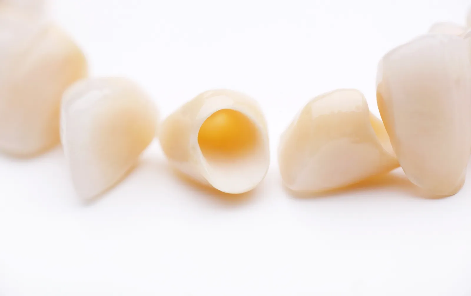 笑顔に自信、鏡を見るのが楽しみに。あなたの本来の輝きを引き出す、セラミック治療とホワイトニング