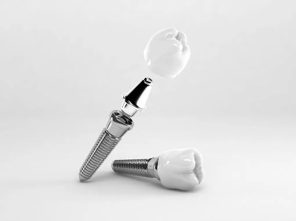 信頼性の高いインプラントメーカーを採用（ストローマン、メガジェン）