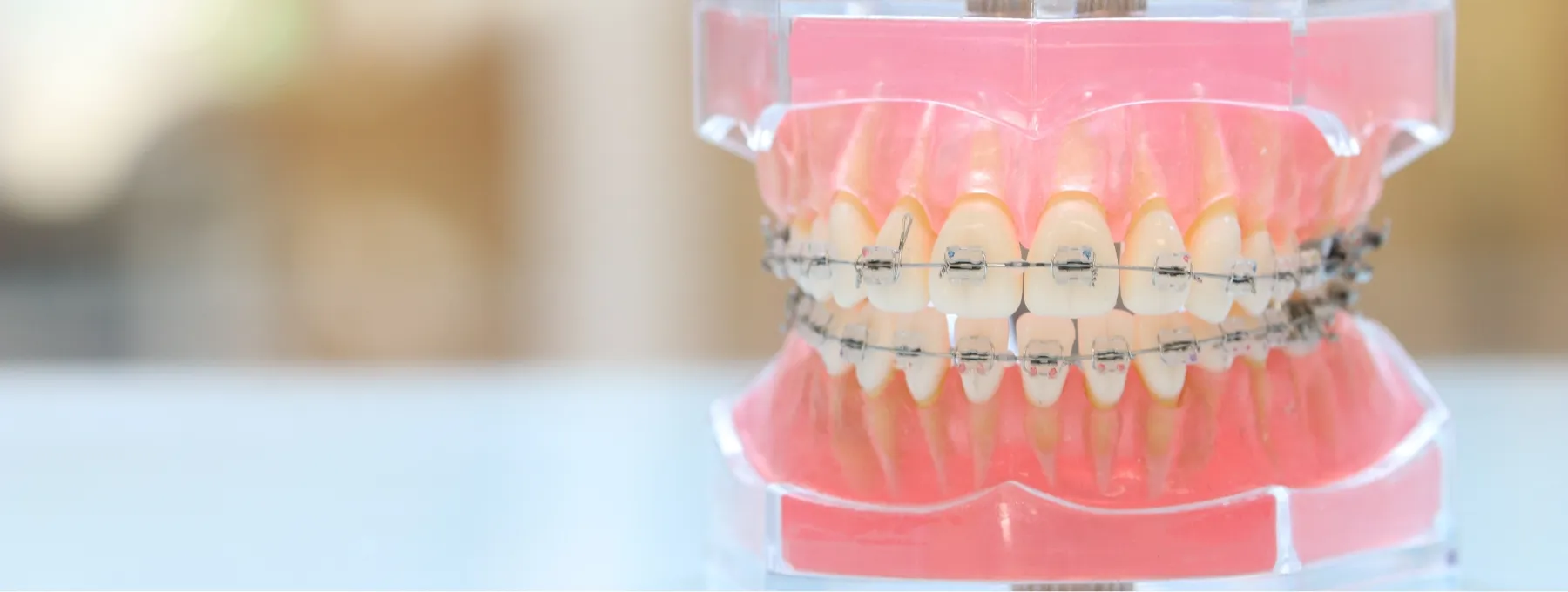 理想の歯並び、実現しませんか？ 歯並びの悩みご相談ください