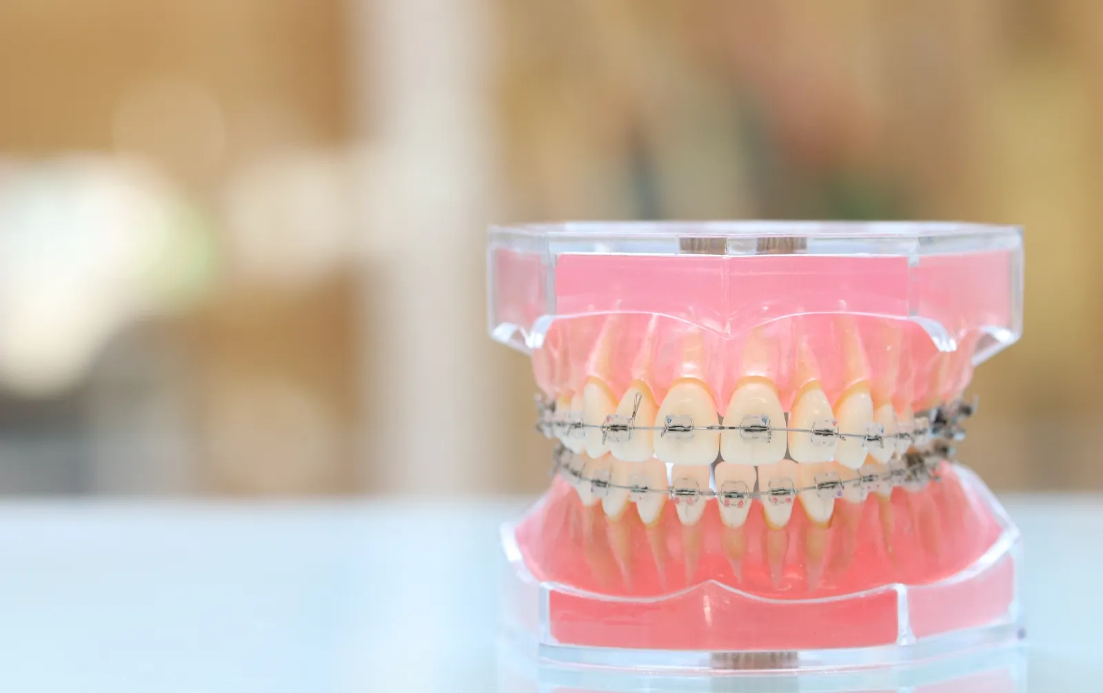 理想の歯並び、実現しませんか？ 歯並びの悩みご相談ください